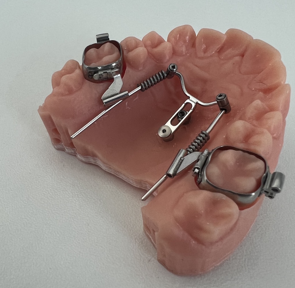 BeneSliderModel drukowany