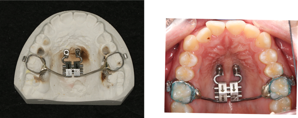 Hybrid Hyrax na modelu gipsowym