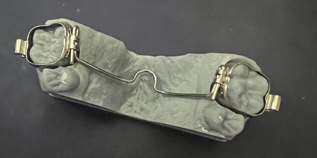 Luk Podniebienny model drukowany