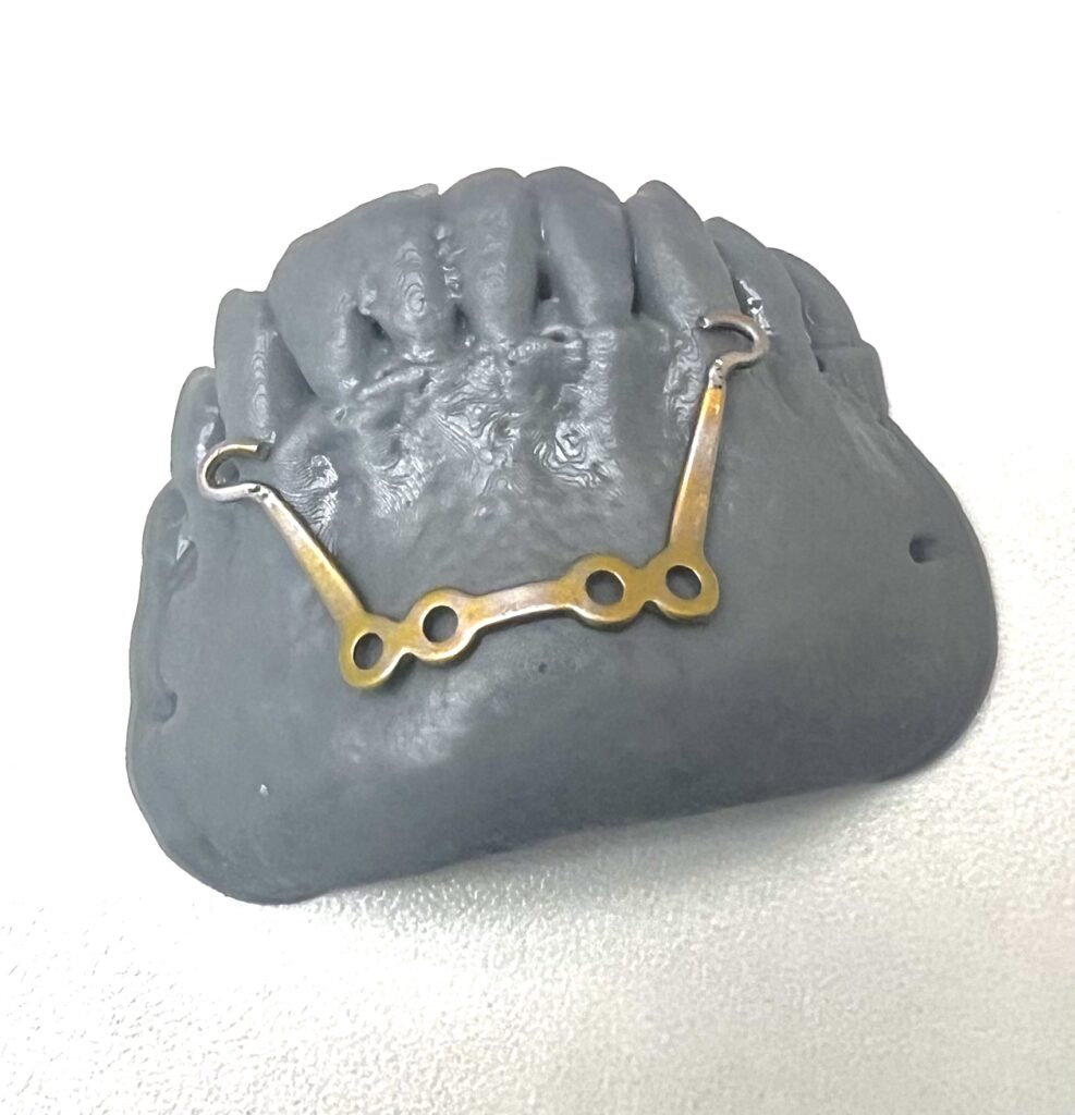 MentoPlate doginane na wydruku żuchwy