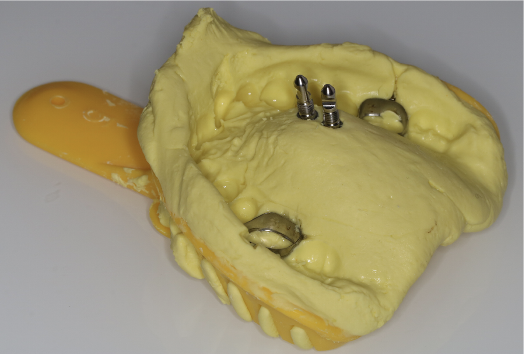 Wycisk z przygotowanymi analogami