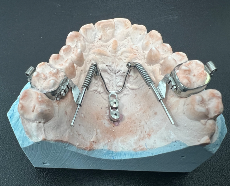 aparat beneslider na modellu gipsowym